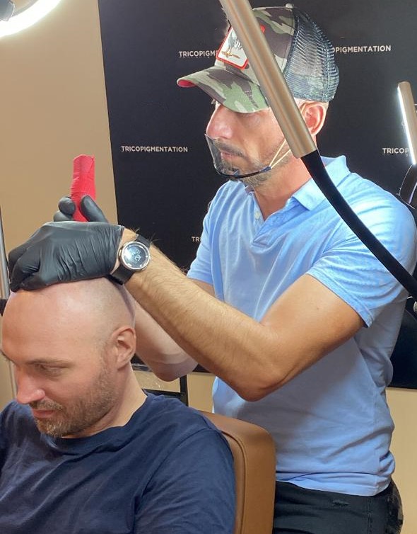 Tricopigmentation capillaire Tricopigmentation à Troyes Dotwork tattoo Dotwork Troyes