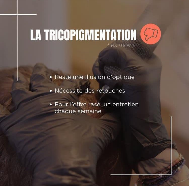 Tricopigmentation capillaire Tricopigmentation à Troyes Dotwork tattoo Dotwork Troyes