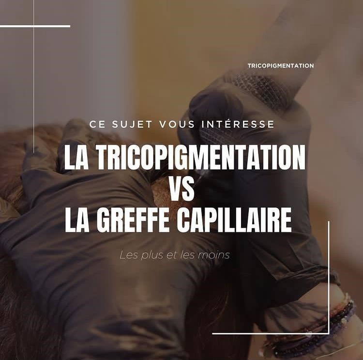 Tricopigmentation capillaire Tricopigmentation à Troyes Dotwork tattoo Dotwork Troyes