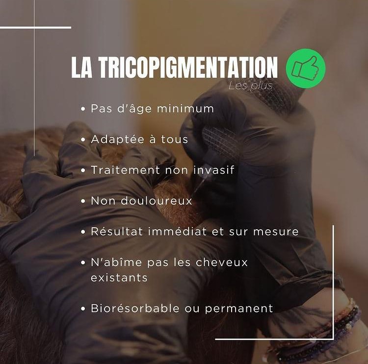 Tricopigmentation capillaire Tricopigmentation à Troyes Dotwork tattoo Dotwork Troyes