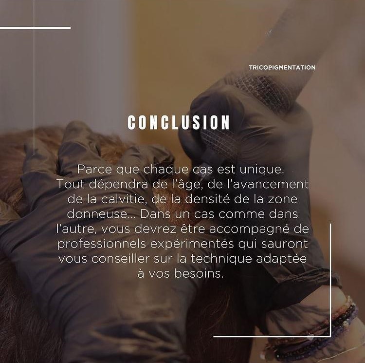 Tricopigmentation capillaire Tricopigmentation à Troyes Dotwork tattoo Dotwork Troyes